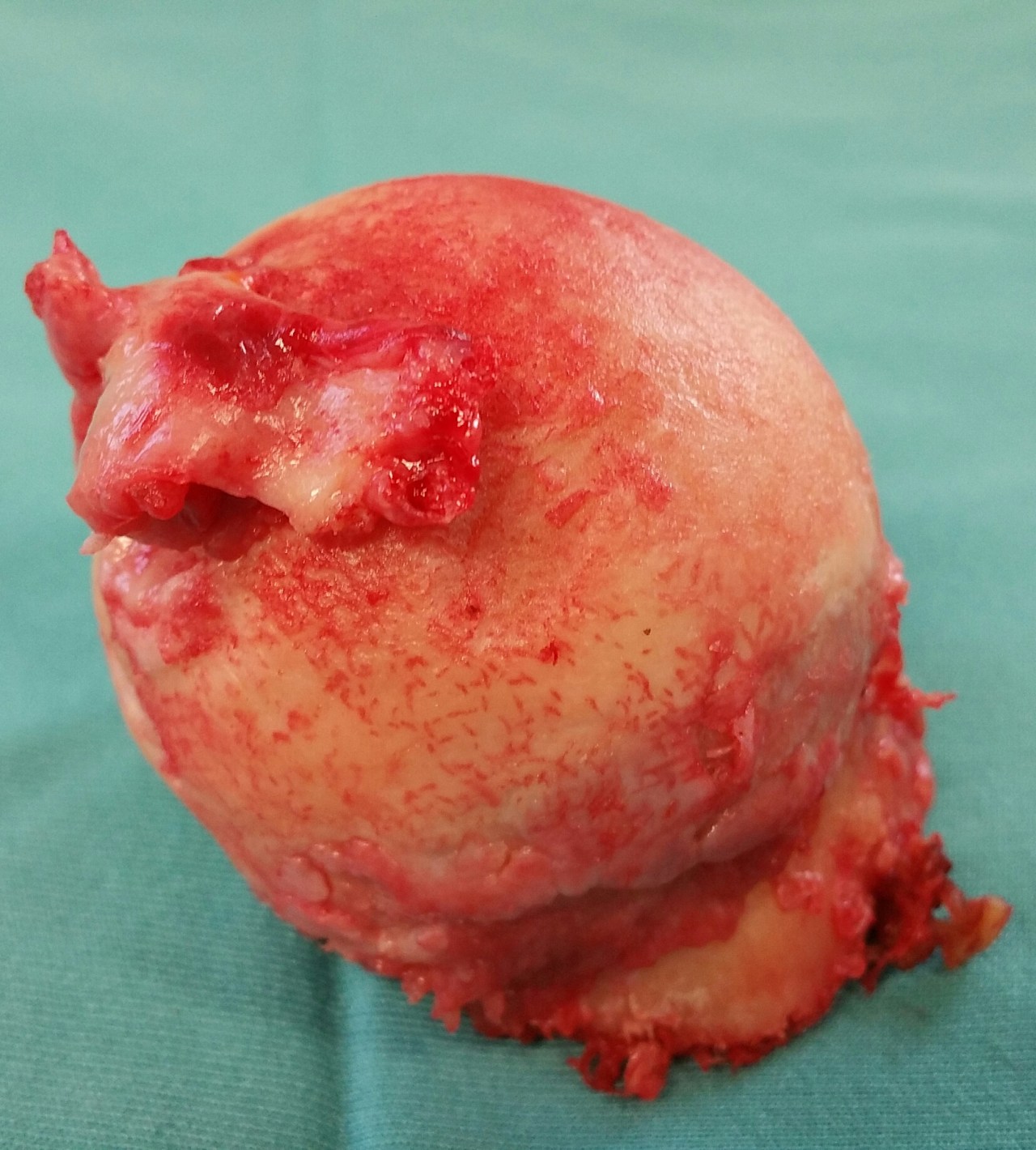 Wer mag gerne Knorpel?&nbsp;#Klinikblog